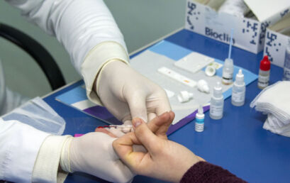 Câmpus Irati da Unicentro realiza testes rápidos para detecção de hepatites B e C