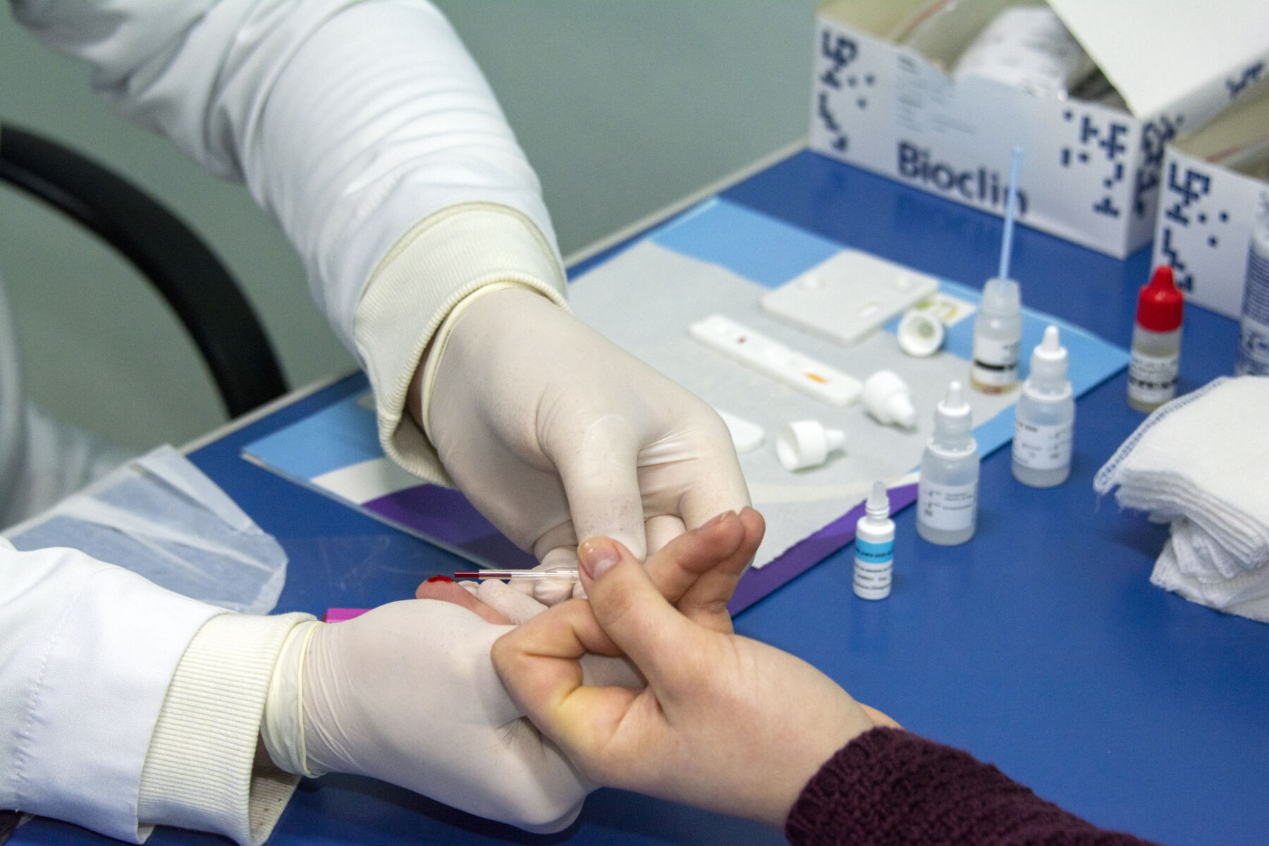 Câmpus Irati da Unicentro realiza testes rápidos para detecção de hepatites B e C