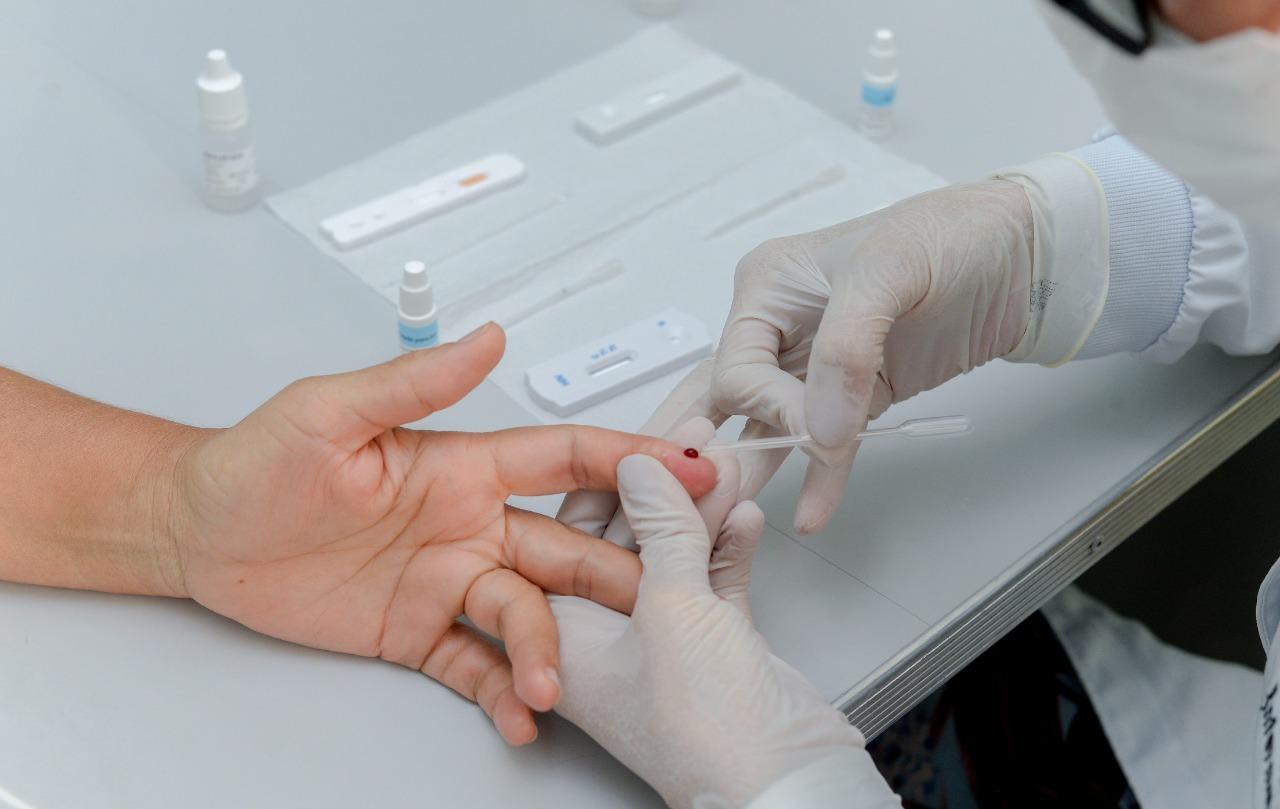 Projeto da Unicentro realiza testagem gratuita de HIV, sífilis e hepatites